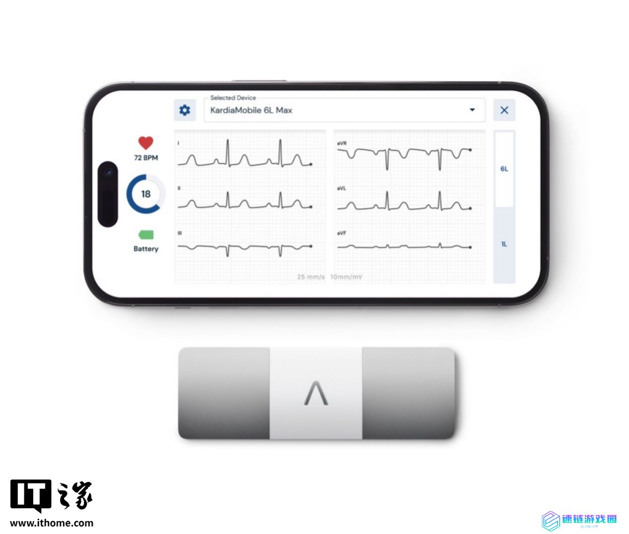 AliveCor 发布 KardiaMobile 6L Max 便携式心电图仪：六导联 ECG 监测，机身小巧能连手机
